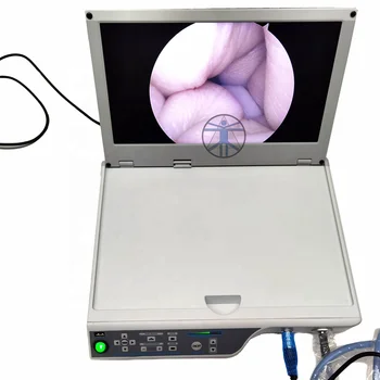 Медицинский лор-назальный эндоскоп, лапароскопическая портативная эндоскопическая камера, трансфораминальный межслойный эндоскоп позвоночника.